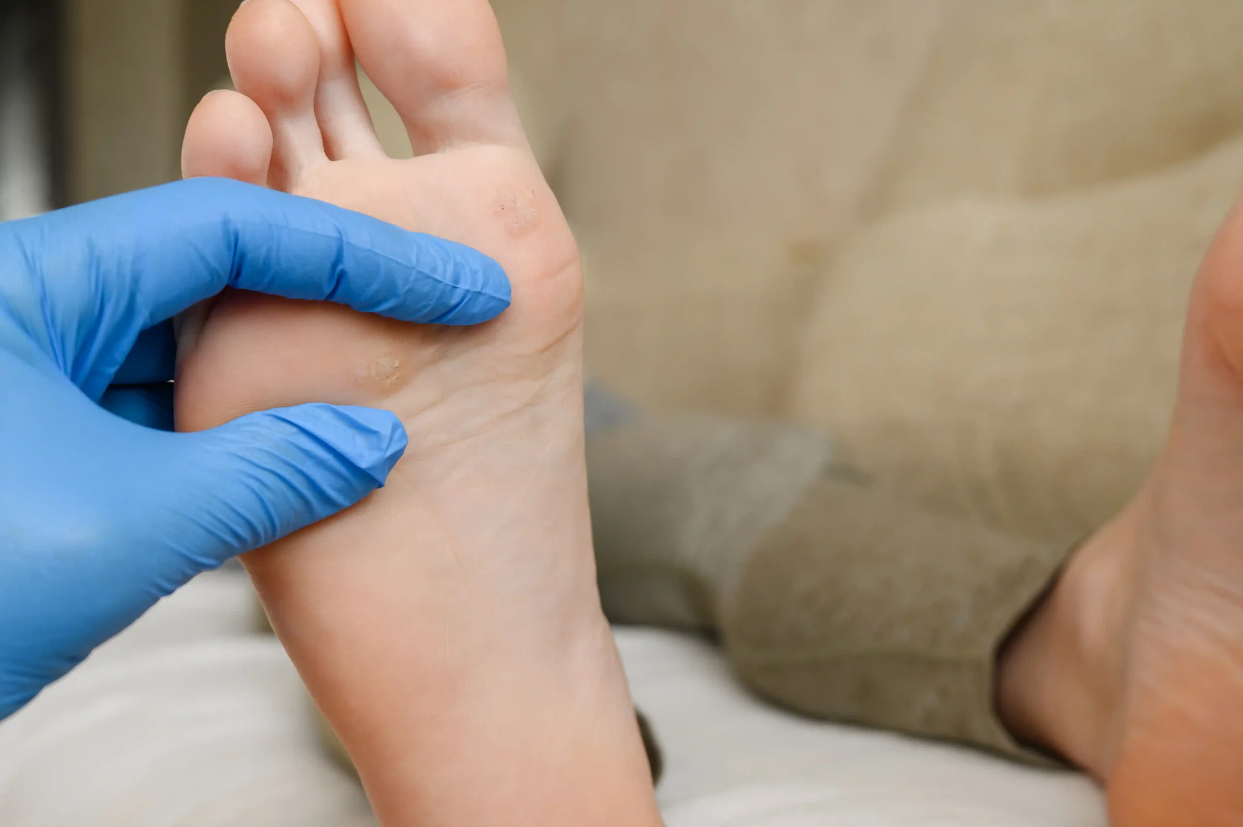Warts Specialist